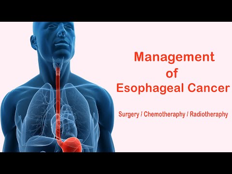  Types of Treatment | फ़ूड पाइप का कैंसर (Esophageal Cancer) 